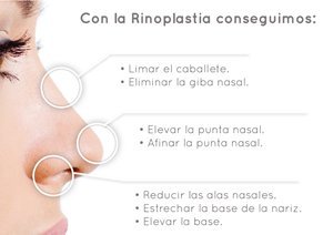 Qué conseguimos con la rinoplastia