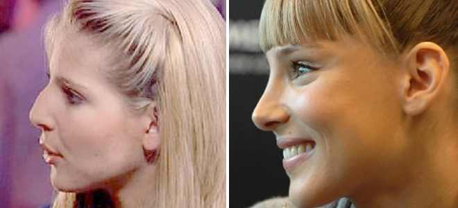 Cirugías de Elsa Pataky