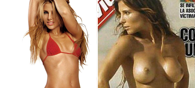 Operación de pecho Elsa Pataky