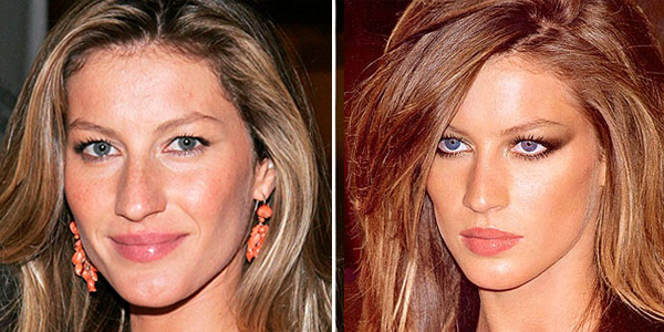 Gisele Bundchen nariz