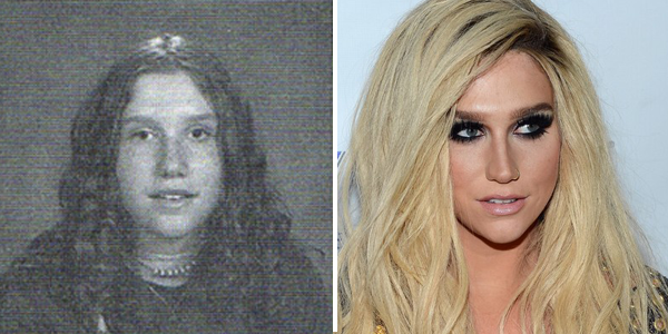 Kesha antes y después operación nariz