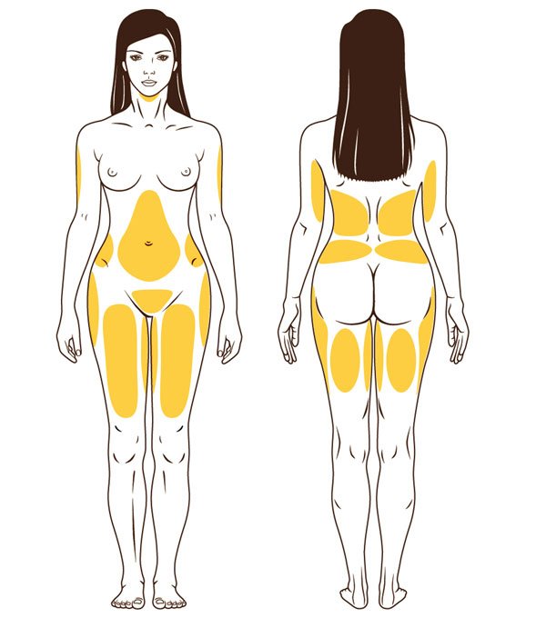 Lipopláser zonas de aplicación