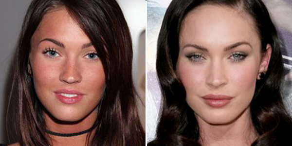 Operación de nariz Megan Fox