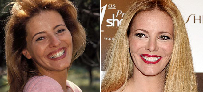 Paula Vázquez cirugía de nariz