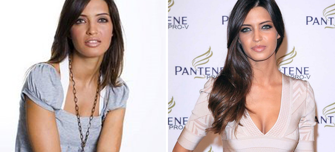 Aumento de pecho Sara Carbonero