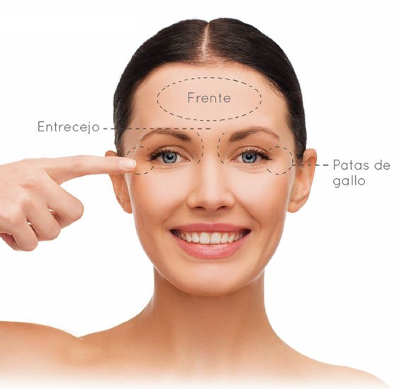 Zonas de aplicación 