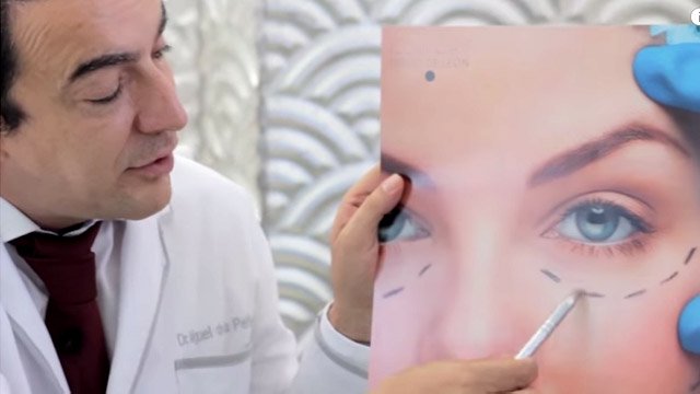 Qué es la Blefaroplastia y Cómo se hace