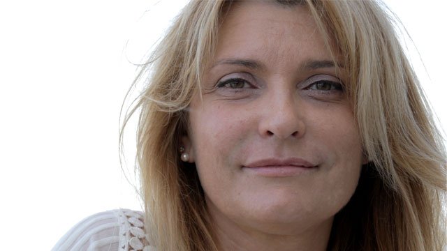 Eliminar Surco Nasogeniano Milagros