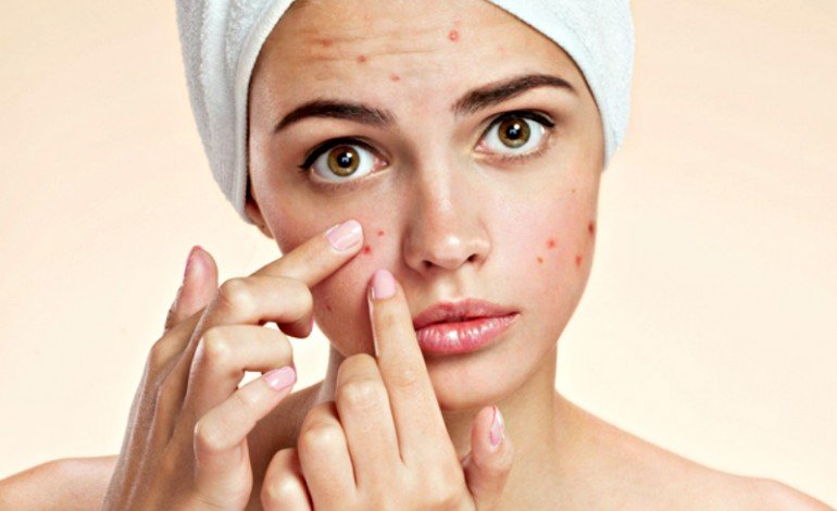 eliminar cicatrices acne eliminar marcas de acne