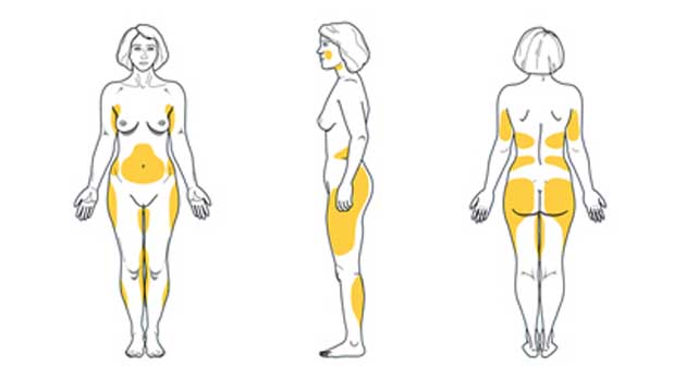 grasa corporal mujer