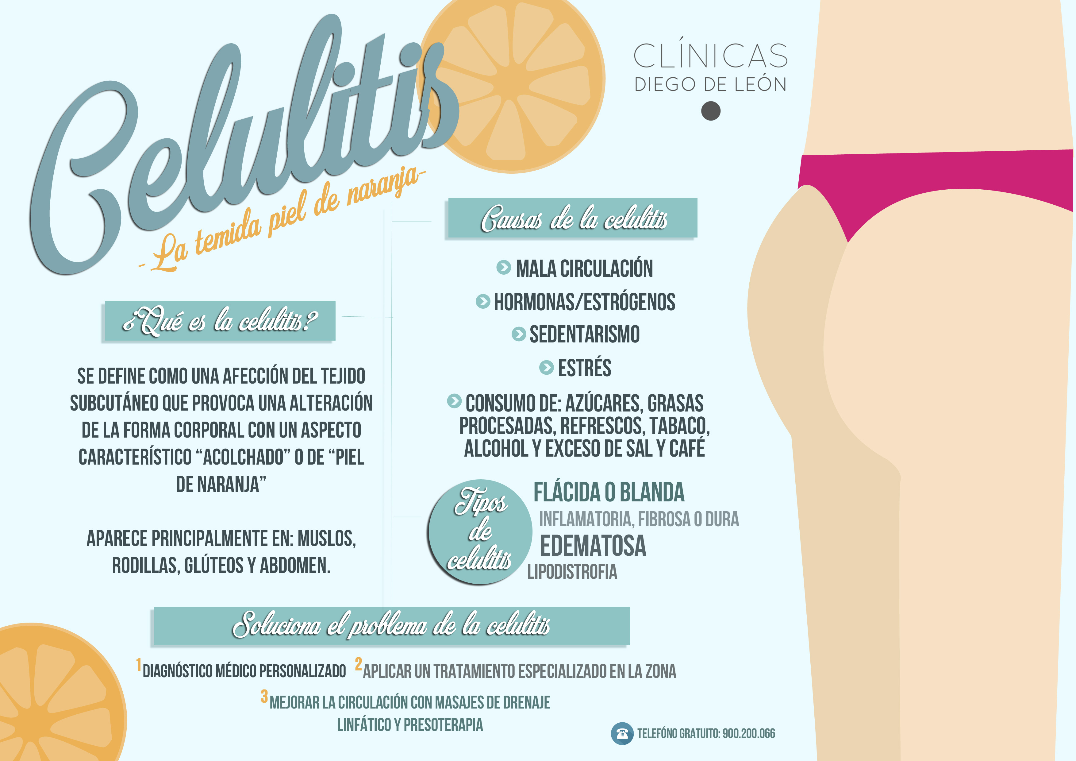 infografia celulitis