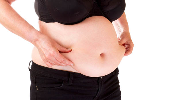 manga gastrica reduccion de estomago