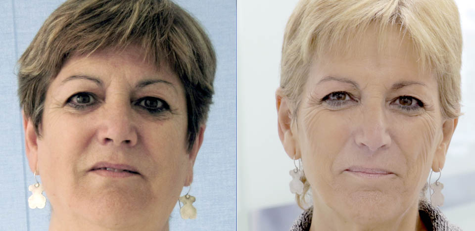 antes-despues-web-carmen