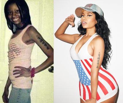 El aumento de culo de Nicki Minaj