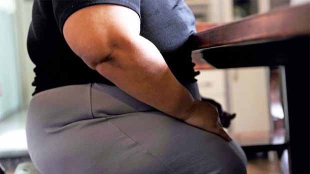 Bypass Gástrico - Problemas de Obesidad