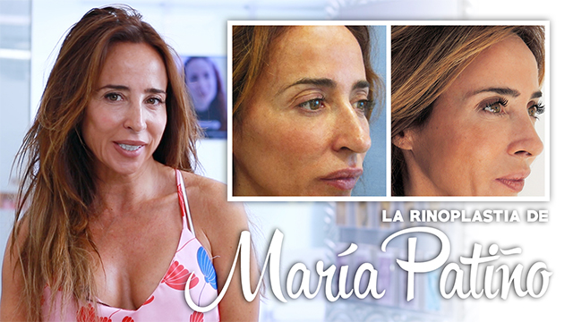 María Patiño Operada | Clínicas Diego de León