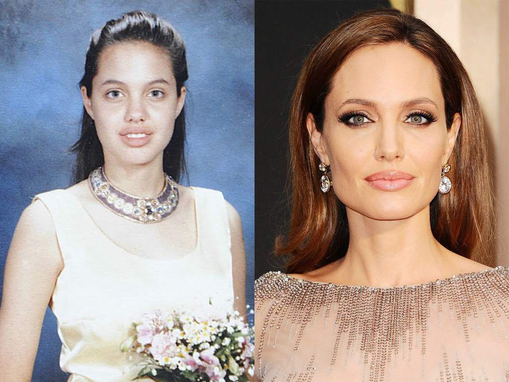 Los tratamientos de medicina estética de Angelina Jolie