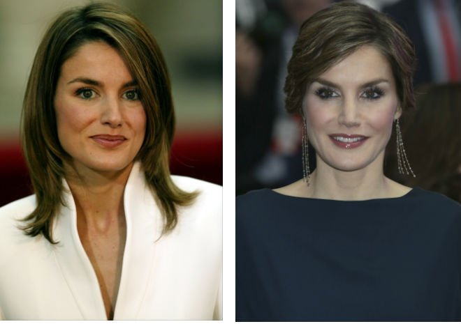 Los tratamientos de medicina estética de Reina Letizia