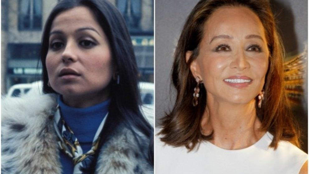 Antes y Después Bolas de Bichat de Isabel Preysler 