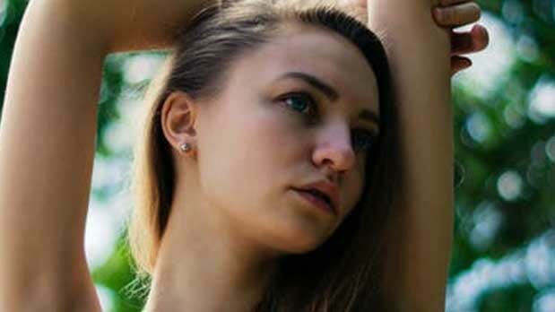 Cicatrices Otoplastia - Operación de orejas