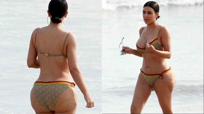 Las estrías de Kim Kardashian