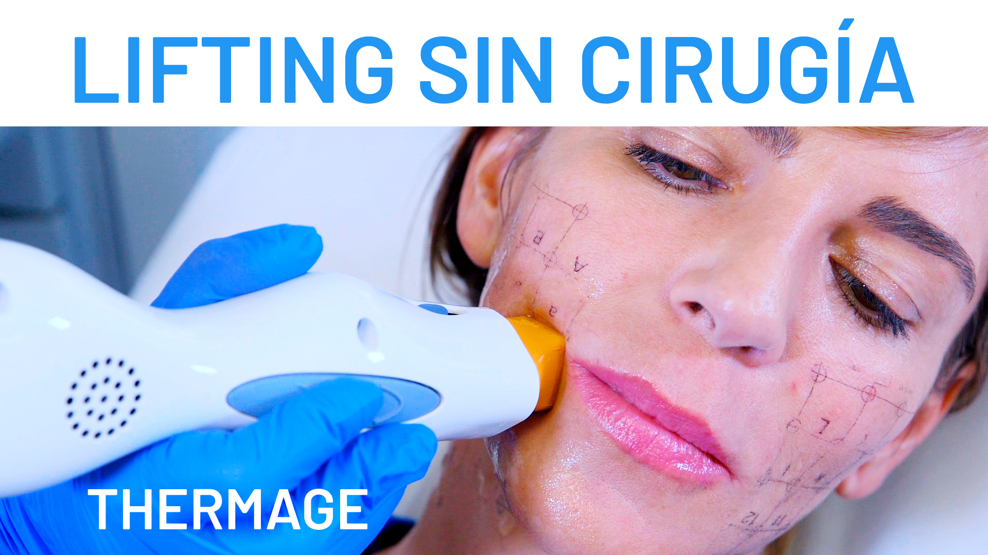 Katia Rocha reafirma su rostro con Thermage CPT