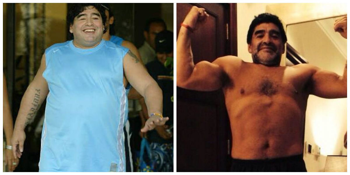 Diego Armando Maradona - ByPass Gástrico Antes y después ByPass Gástrico de Diego Armando Maradona