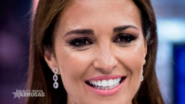 BEAUTY_DRAMA_Arrugas_Paula_