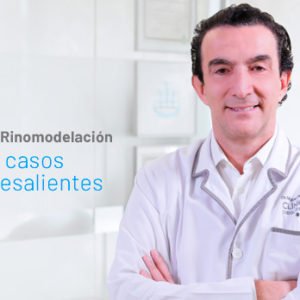 Mejores Casos de Rinoplastia - Clínicas Diego de León