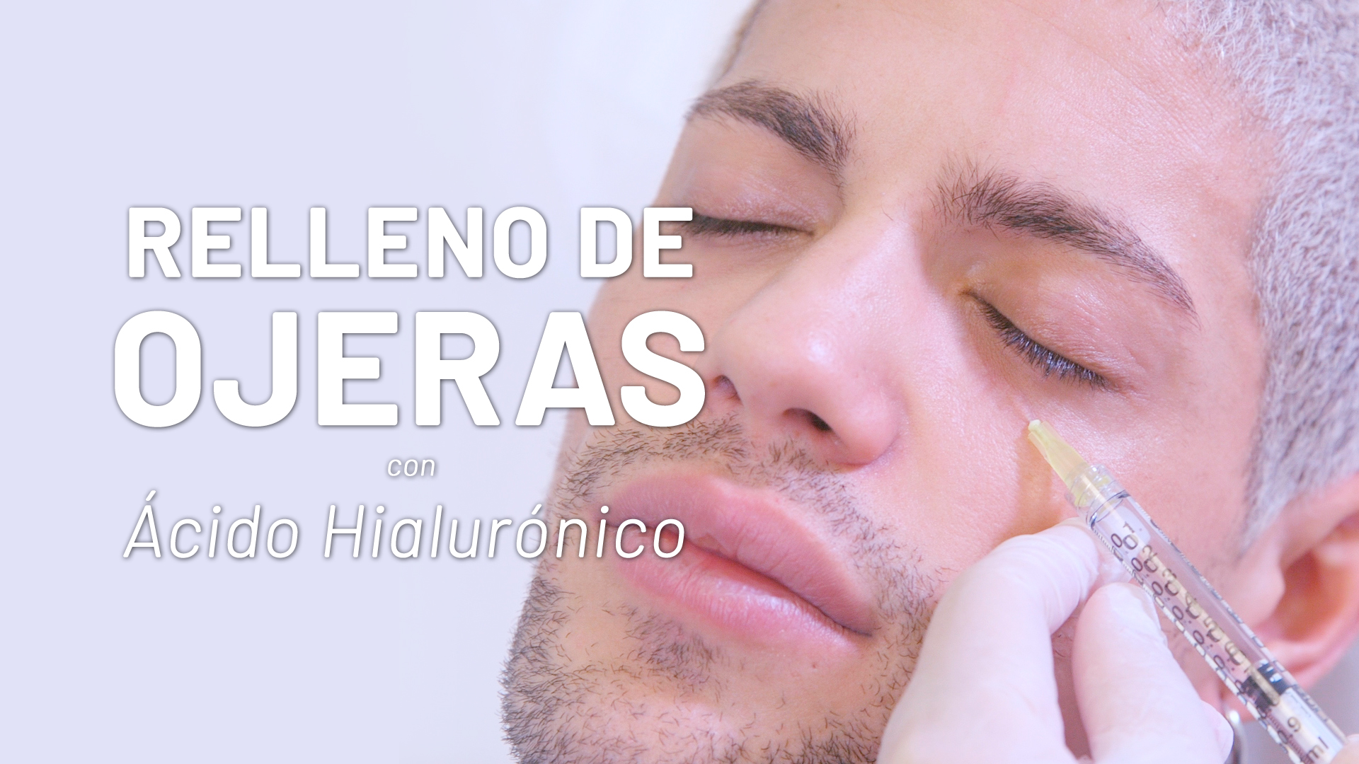 David Lafuente elimina ojeras con Ácido Hialurónico [Vídeo]