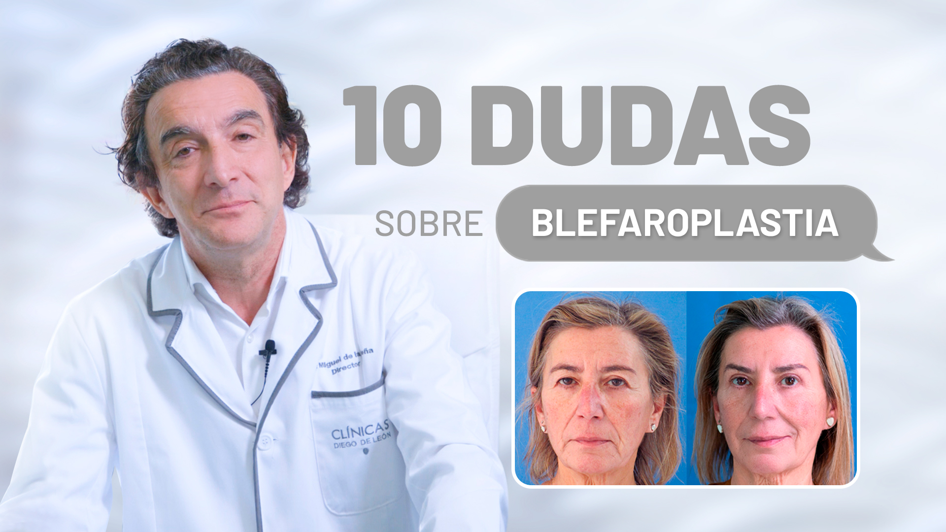Nuestro director médico resuelve las 10 DUDAS MÁS COMUNES sobre la BLEFAROPLASTIA