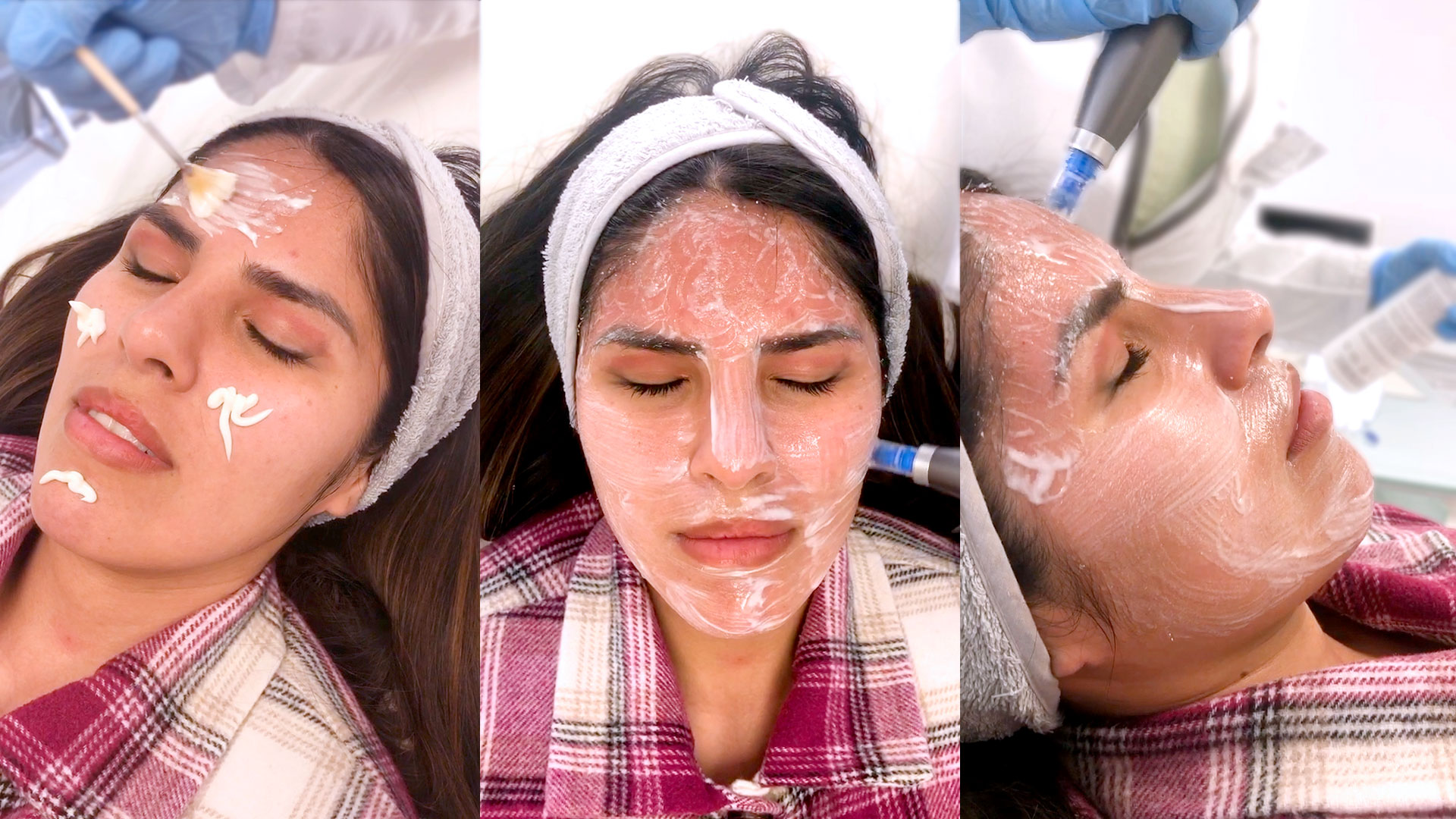 Isa Pantoja tratamientos faciales