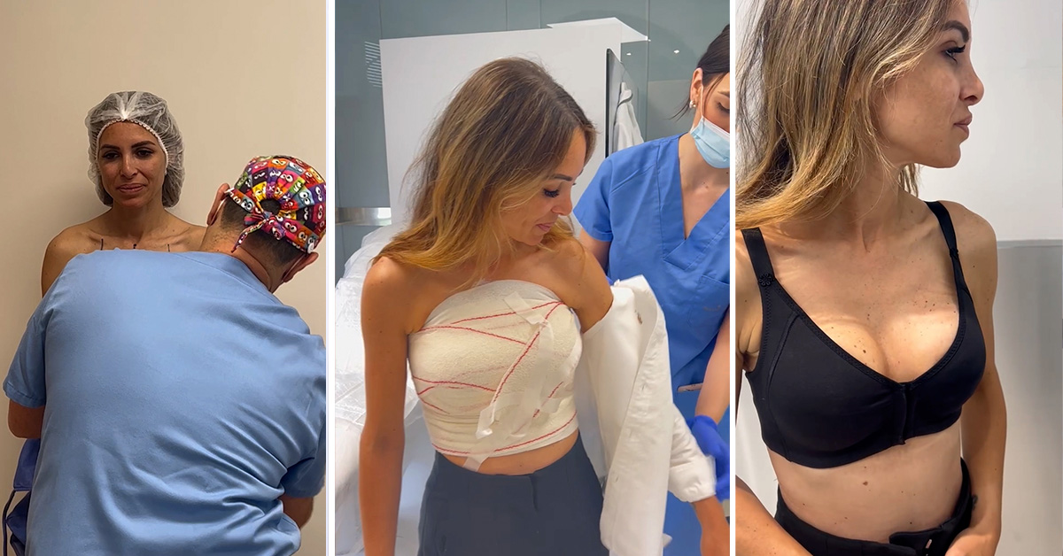 operarse el pecho en verano