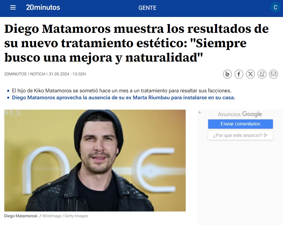 ¡Diego Matamoros eleva sus facciones en 20 minutos!